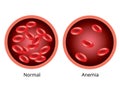 Blood of healthy human and blood vessel with anemia