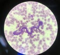 microphilaria on red blood cells background