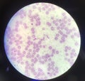 Blood parasite Trypanosoma on red blood cells background