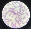 Blood parasite Trypanosoma on red blood cells background