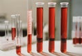 Blood plasma in test tubes for plasmalifting