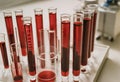 Blood plasma in test tubes for plasmalifting