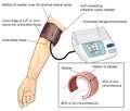 Blood pressure measurement