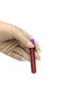 Blood sample