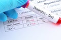 Diabetes test result