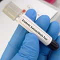 Blood sample for diabetic ketoacidosis (DKA) test. A complication of diabetes that can lead to a coma or even death.