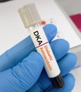 Blood sample for diabetic ketoacidosis (DKA) test. A complication of diabetes that can lead to a coma or even death. Royalty Free Stock Photo