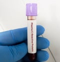 Blood sample for plasma CRP levels significantly predict greater risk of ischemic stroke or TIA in elderly men and women Royalty Free Stock Photo