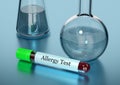 Blood sample in test tube for allergy test in laboratory Royalty Free Stock Photo