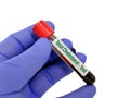 Blood sample for Total cholesterol test