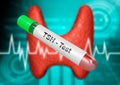 Blood sample tube for testing thyroid stimulating hormone. TSH test Royalty Free Stock Photo