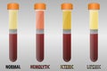 Blood serum common types