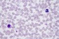 Plasmodium vivax