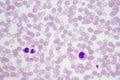 Plasmodium vivax