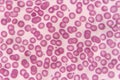 Blood smear Royalty Free Stock Photo