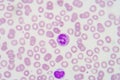 Blood smear