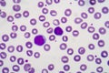 Blood smear