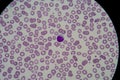 Blood smear