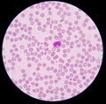 Blood smear.