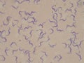 Blood smear of a patient with sleeping sickness. Trypanosoma brucei