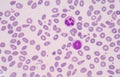 Blood smear Royalty Free Stock Photo