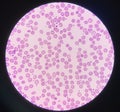 Blood smear show platelet increase