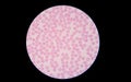 Blood smear under microscope is showing normal red blood cell. Royalty Free Stock Photo