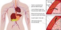 Blood sugar glucose absorbtion in a human body infographics