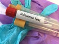 Blood test tube for Influenza virus testing