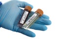 Blood Test Tube And Vaccine In Doctor Hand,