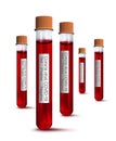 Blood test tubes for medical laboratory analysis and corona virus test