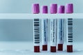 Blood test tubes in a row for laboratory blood analysis. Corona Virus laboratory testing patient blood samples. Positive