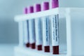 Blood test tubes in a row for laboratory blood analysis. Corona Virus laboratory testing patient blood samples. Positive