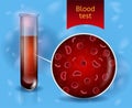 Medical Blood Test Realistic Vector Concept