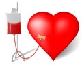 Blood transfusion to heart Royalty Free Stock Photo