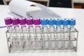 Blood tube test for analysis in the laboratory of haematology / Royalty Free Stock Photo