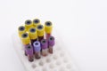 Blood tubes, medical sector, test tube