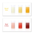 Blood In Urine Color Infographic Chart Yellow Red Royalty Free Stock Photo