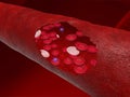 Blood vessel with bloodcells Royalty Free Stock Photo