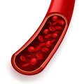 Blood vessel in section. Normal healthy coronary artery, free particle flow, erythrocyte movement, donor components