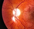 Blood vessels in human eye.