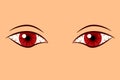 Bloodshot eyes illustration. Clipart image.