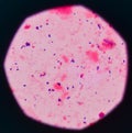 Blue bacteria cells