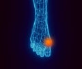 Blue contour foot and red spot of pain on a dark background. Low-poly element for medicine and orthopedics