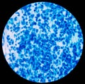 Blue leukocyte