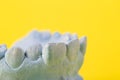 Blue plaster model of an impression of a patient's jaw at an orthodontist dentist on a yellow background Royalty Free Stock Photo