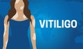 Blue Vitiligo Skin Illness Banner Background
