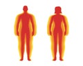 BMI classification measurement infographic set concept. Man and woman Body Mass Index level. Combination people figures