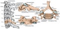 BOARD Cervical spine, sixth cervical vertebra