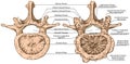 BOARD degenerative changes vertebra